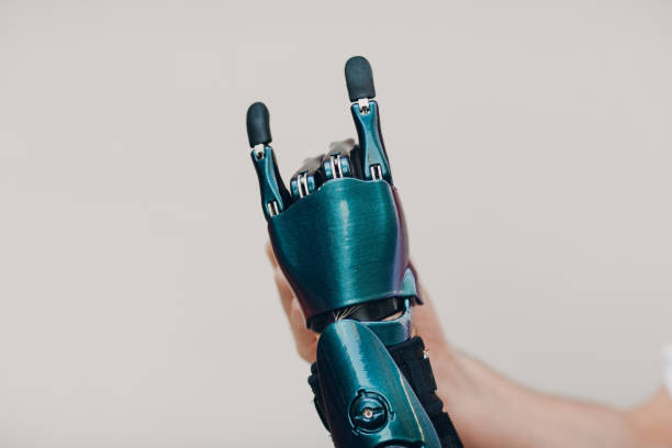 istock Young disabled man with artificial prosthetic hand in casual clothes. 1340996803