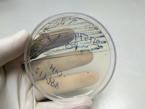 Culture and sensitive test at medical microbiology laboratory growth of streptococcus pneumoniae, staphylococcus aureus, E. Coli, Klebsiella on Hi crome, UTI agar medium.