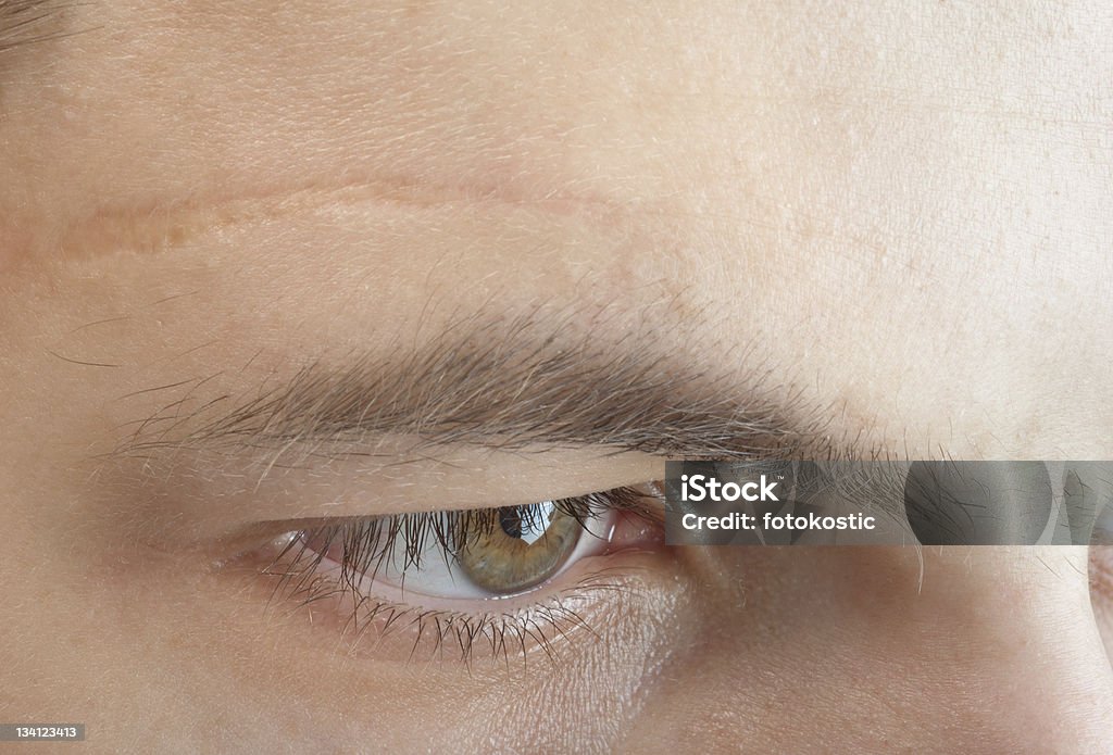 scar on forehead Scar Stock Photo