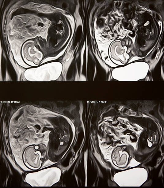 istock intrauterine baby 134124549