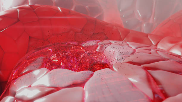istock 3D rendering of tumor site 1341550293