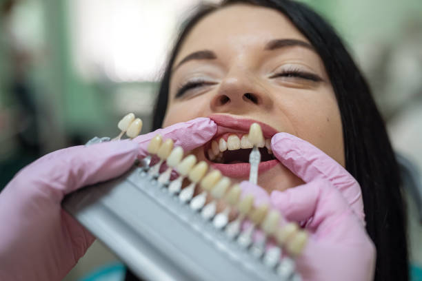 istock Dentist comparing patient's tooth with color sampler in dentistry 1341637601