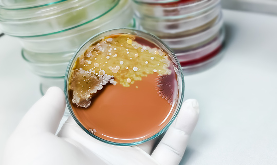 Colonies of Candida Albicans growth on Chocolate agar from sputum culture
