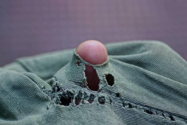 istock one brown finger in a hole in torn green fabric 1341715514