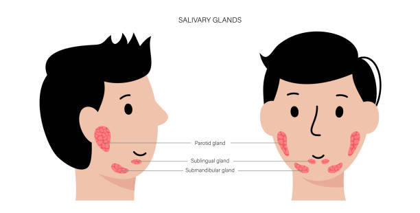 Salivary gland concept Salivary gland in human mouth. Parotid, submandibular, and sublingual glands. Produce of saliva through a system of ducts. Xerostomia oral disease anatomical poster. Medical flat vector illustration. salivary gland surgery stock illustrations