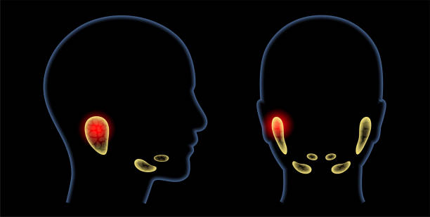 Salivary gland concept Inflammation of a salivary glands in human mouth. Parotid, submandibular, and sublingual gland. Produce of saliva through a system of ducts. Xerostomia oral disease. Medical 3d vector illustration. salivary gland surgery stock illustrations
