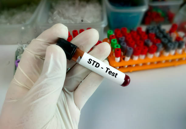 std 검사를 위한 혈액 샘플, 성병 진단 의료 및 의료 개념. - condom sex sexually transmitted disease aids 뉴스 사진 이미지