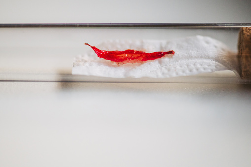 Red Mucus Cat Urine Clot Stock Photo - Download Image Now - Blood Clot ...