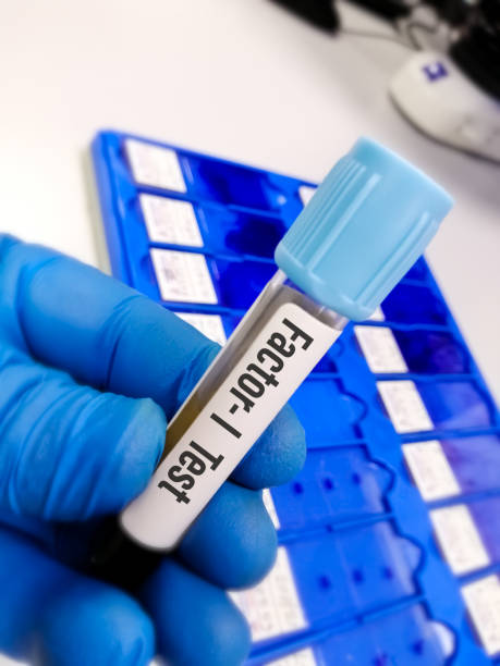 istock Blood sample for Factor 1 test, diagnosis of coagulation disorder 1341843409