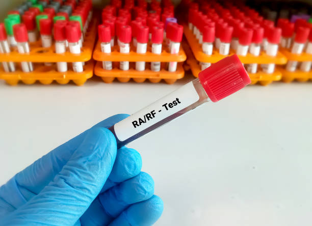 Cek Lab Rf 200+ Rf Lab Stock Photos, Pictures & Royalty-Free Images - iStock