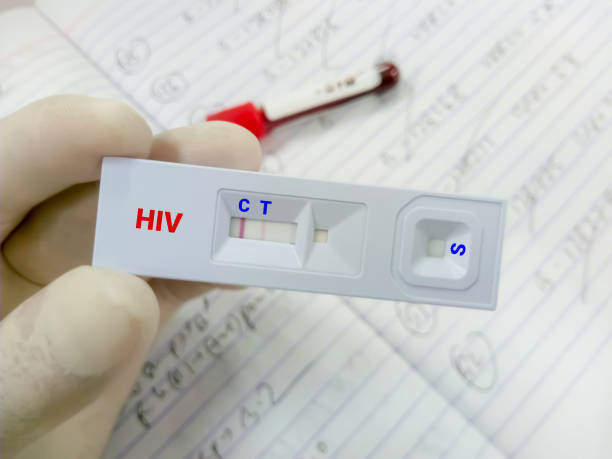 szybki test przesiewowy w kierunku hiv (ludzki wirus niedoboru odporności). technik posiada kasetę z szybkim testem, zdrowie i koncepcję medyczną - immunodeficiency zdjęcia i obrazy z banku zdjęć