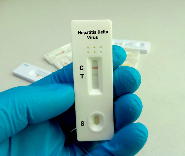 istock Close view of technician or technologist hand hold a device of Hepatitis Delta Virus (HDV) or  Hepatitis D rapid screening test, showing positive result. 1341899731