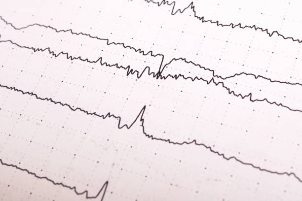 grafico dell'elettroencefalogramma su carta bianca in primo piano - pulse trace computer monitor eeg equipment foto e immagini stock