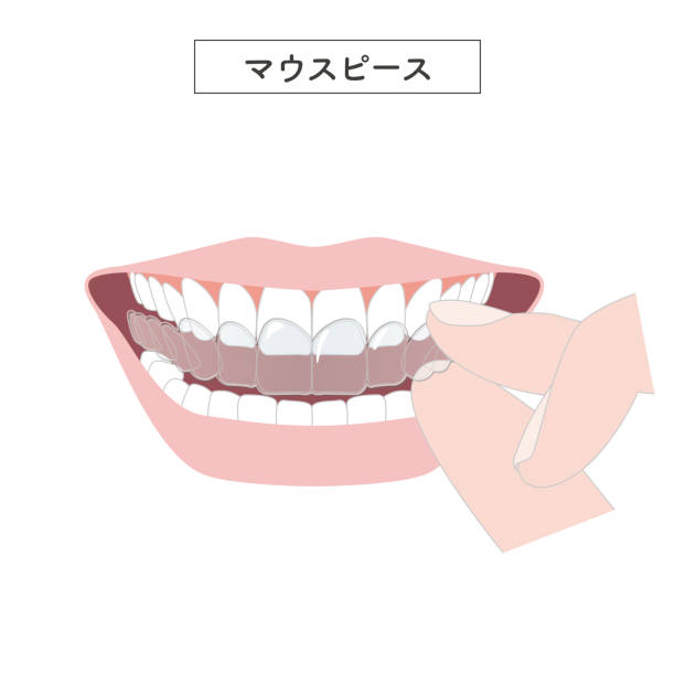 illustrations, cliparts, dessins animés et icônes de illustration du port d’un embout buccal - human teeth dental hygiene dentist office human mouth