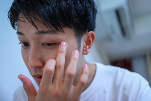 Skincare / Dermatology Concepts: Young asian man should carefully take care of his eye skin