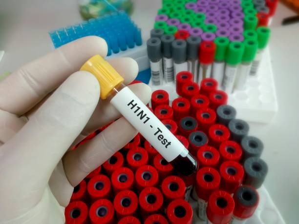 Blood sample for H1N1 influenza virus testing stock photo