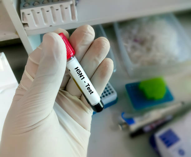 Blood sample for H5N1 test stock photo