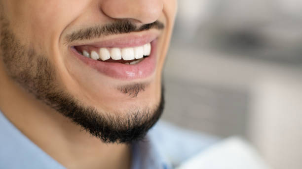 concepto de odontología. primer plano de un joven y feliz hombre de oriente medio sonriendo con dientes perfectos - blanqueamiento dental fotografías e imágenes de stock