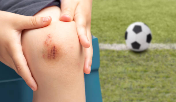 child male soccer player suffering from knee injury Close-up of a child male soccer player suffering from knee injury on the field scraping stock pictures, royalty-free photos & images