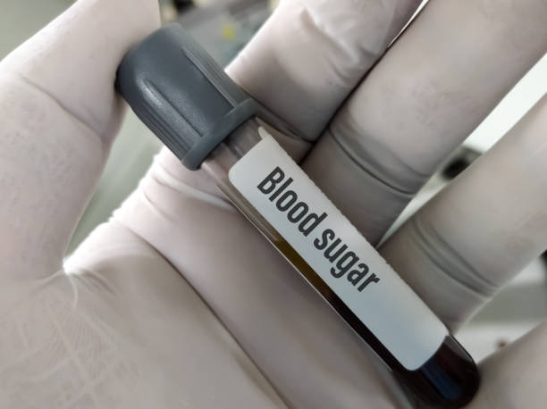 техник или ученый держит пробоотку теста rbs (random blood sugar) - blood sugar test стоковые фото и изображения