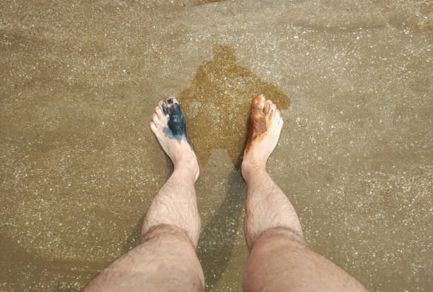 Treatment for gout with natural mud