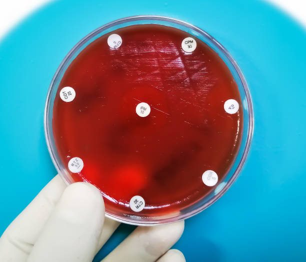 istock Petri dish with drug sensitivity testing, showing sensitive and resistance against antibiotic 1342468971