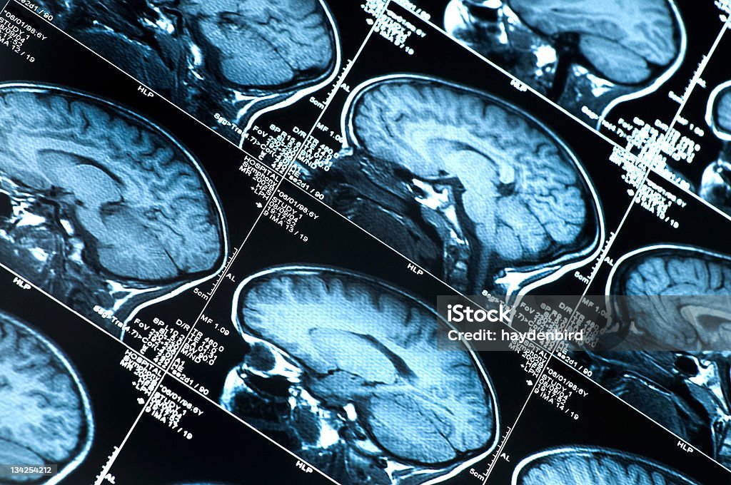 Cerveau montrant Scanner à résonance magnétique plusieurs images de la tête et du crâne - Photo de Cerveau humain libre de droits