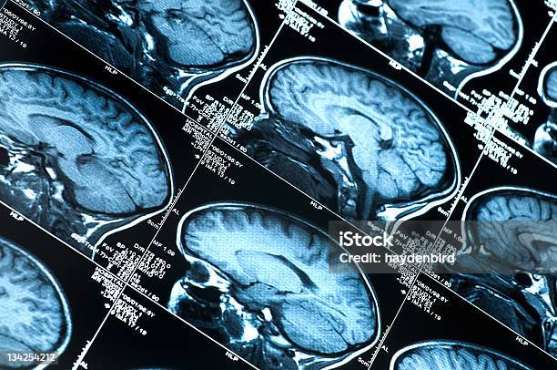 Photo libre de droit de Cerveau Montrant Scanner À Résonance Magnétique Plusieurs Images De La Tête Et Du Crâne banque d'images et plus d'images libres de droit de Cerveau humain