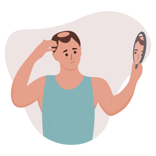 Man looking in the mirror at his baldness. Man looking in the mirror at his baldness. Hair loss, alopecia in young age, hair problems. Vector illustration of a person with disease problems. controlled-chaos stock illustrations