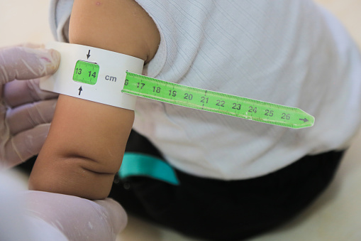 Measuring malnutrition using strap MUAC mid-upper-arm-circumference. A doctor examines child malnutrition