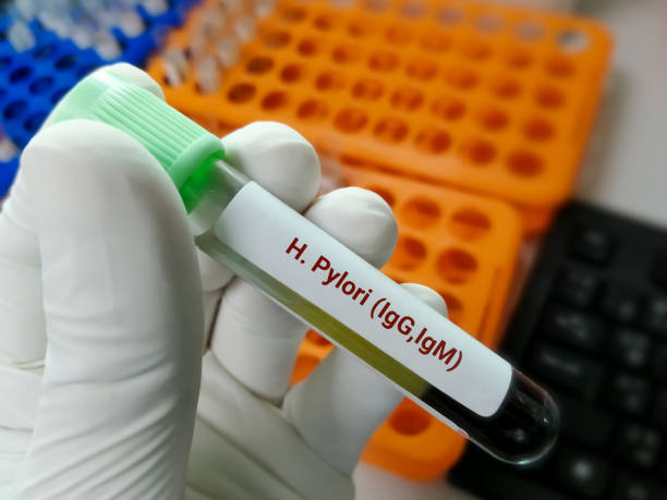 istock Blood sample for H. Pylori (IgG, IgM) test 1342687304