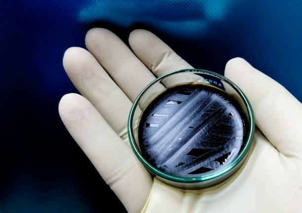 istock Microbiologist hold petri dish with bile esculin agar (BEA) showing bacterial colonies of Enterococcus spp. Bacterial Black colonies. blue background, closeup 1343284902