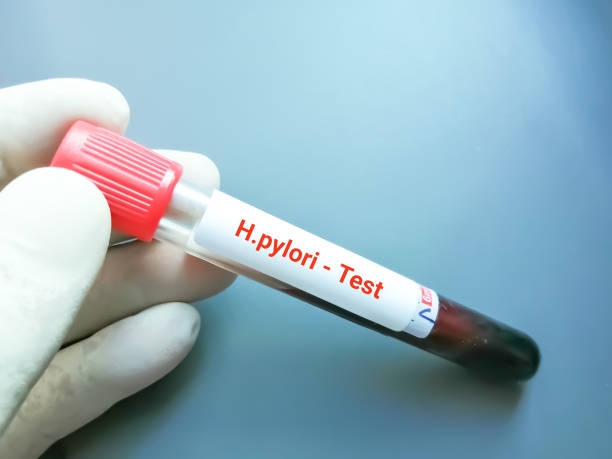 muestra de sangre para la prueba de h. pylori (helicobacter pylori) - pylori fotografías e imágenes de stock