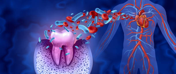 Tooth Decay Disease Tooth decay and heart disease as an unhealthy molar with periodontitis due to poor oral hygiene health problem as a bacteria infection in the blood as a concept with inflammation as a 3D illustration on a blue background. heart internal organ photos stock pictures, royalty-free photos & images