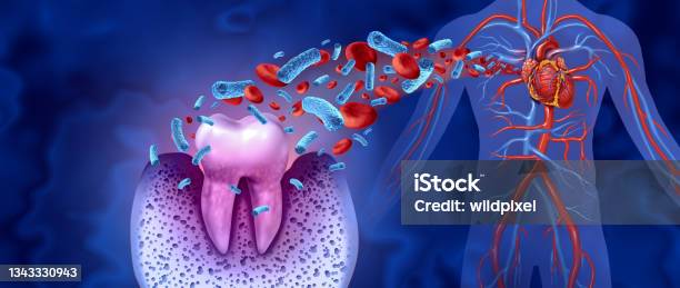 Tooth Decay Disease Stock Photo - Download Image Now - Dental Health, Periodontal Disease, Teeth