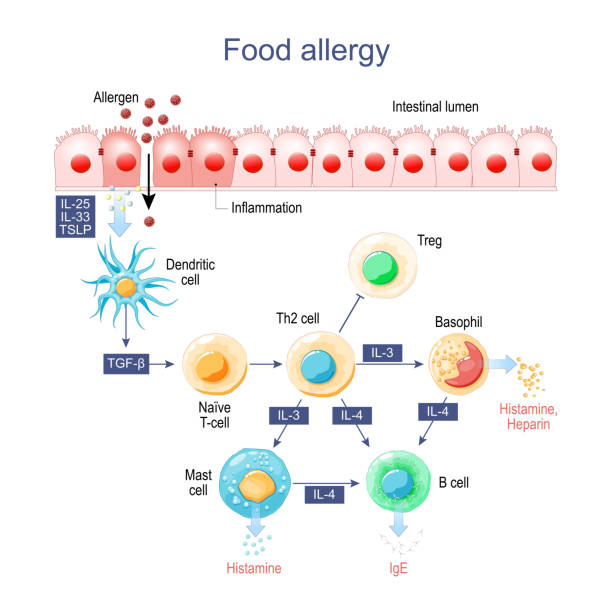 ilustraciones, imágenes clip art, dibujos animados e iconos de stock de alergia alimentaria. inflamación del intestino - dendrita