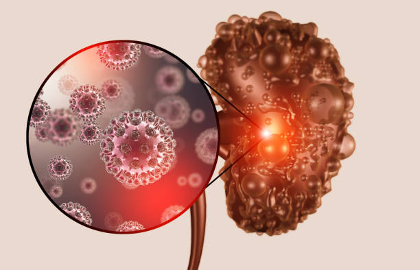 istock Kidney disease concept. Viral infection. 3d illustration 1343478410