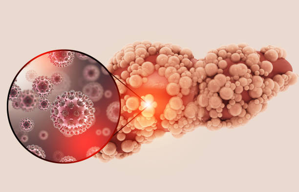 istock Liver cirrhosis. liver disease. 3d illustration 1343484220
