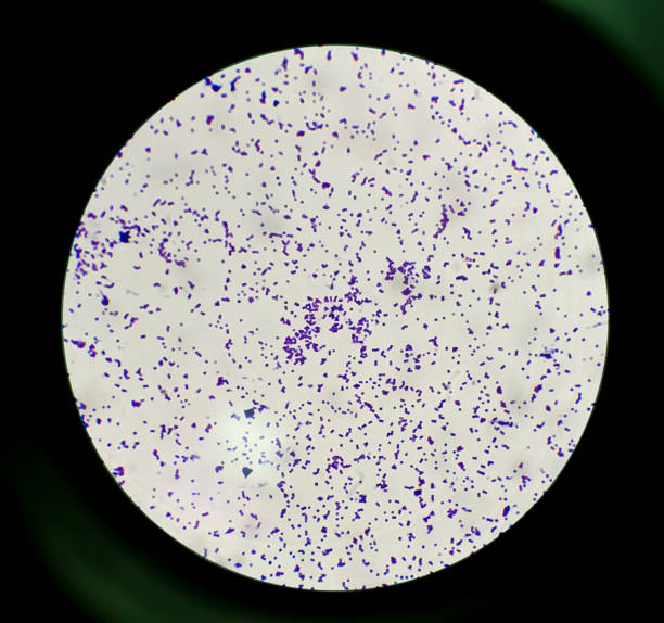 las colonias de tinción de gram bajo microscopio de luz 100x muestran bacterias gram positivas staphylococcus saprophytes. - staphylococcus epidermidis fotografías e imágenes de stock