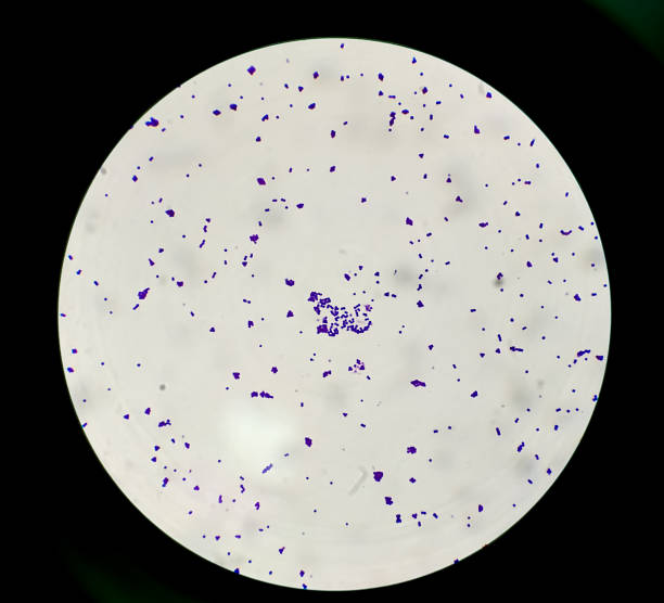 las colonias de tinción de gram bajo microscopio de luz 100x muestran bacterias gram positivas staphylococcus saprophytes. - staphylococcus epidermidis fotografías e imágenes de stock