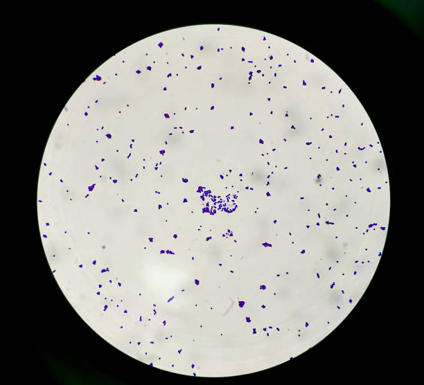 100x光顕微鏡下でのコロニーグラム染色は、グラム陽性菌のブドウ球菌の生理食突を示す。 - staphylococcus epidermidis ストックフォトと画像