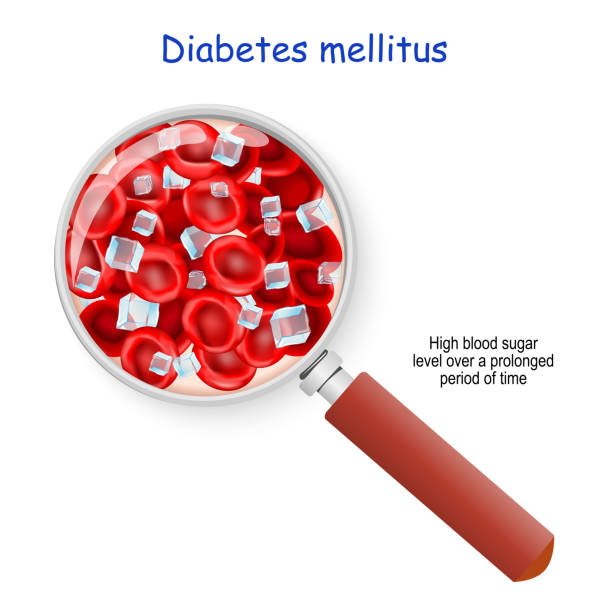 illustrazioni stock, clip art, cartoni animati e icone di tendenza di diabete mellito. alto livello di zucchero nel sangue - diabetes high up blood sugar test glucose