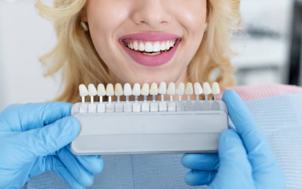 istock Dentist applying sample from tooth scale to patient white teeth 1344028866