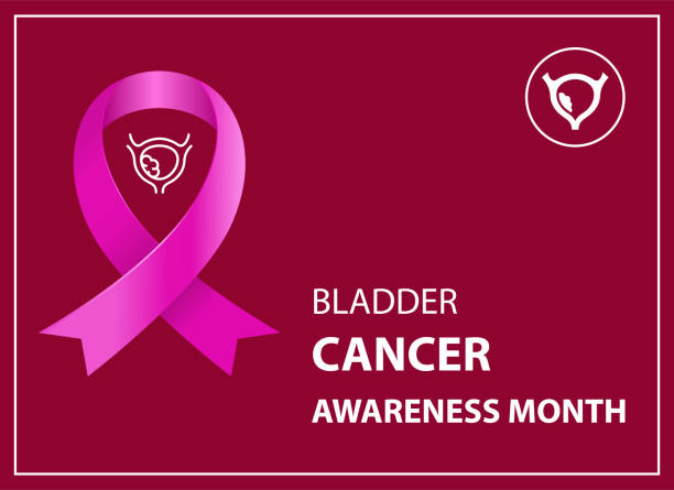 Bladder cancer awareness poster Bladder cancer awareness poster bladder cancer stock illustrations