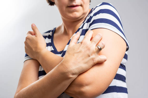 Woman scratching her arm isolated on grey background. People scratch the itch with hand, Arm, itching, Concept with Healthcare And Medicine. Woman scratching her arm isolated on grey background. self harm photos stock pictures, royalty-free photos & images