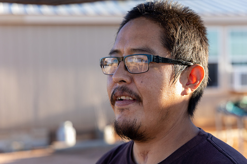 Portrait of Navajo Native American Young Man near home in Monument Valley with scar from tracheotomy from contracting Covid-19