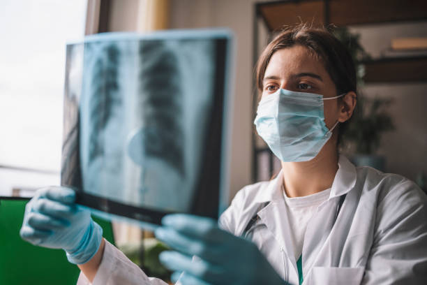 médecin analysant l’image radiographique pulmonaire - human cardiopulmonary system photos et images de collection