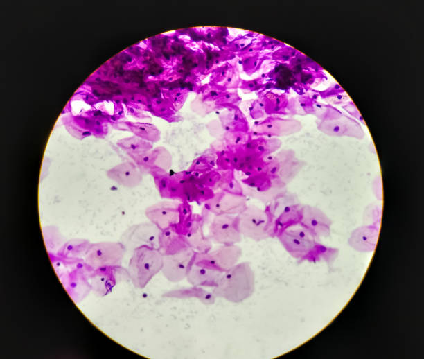 istock Microscopic view of normal human cervix cells. Squamous epithelium cells. Pap smear. 1344422182