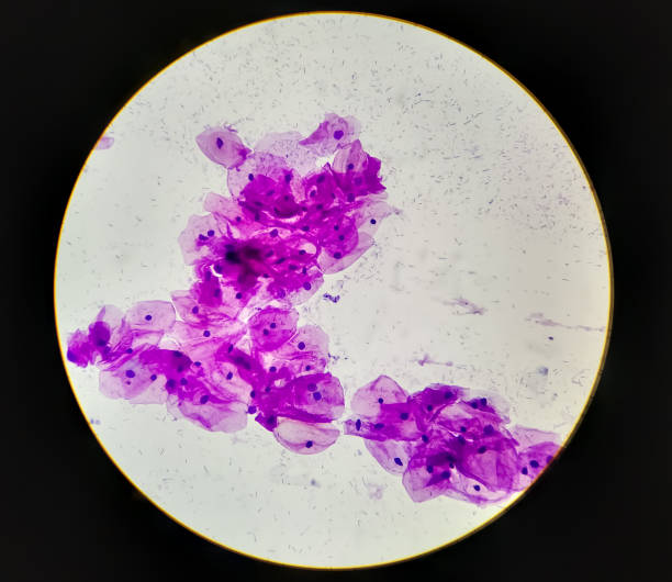 Microscopic view of normal human cervix cells. Squamous epithelium cells. Pap smear. Microscopic view of normal human cervix cells. Squamous epithelium cells. Pap smear. Pap's diagnosis of cervical cancer at medical laboratory. squamous cell carcinoma photos stock pictures, royalty-free photos & images