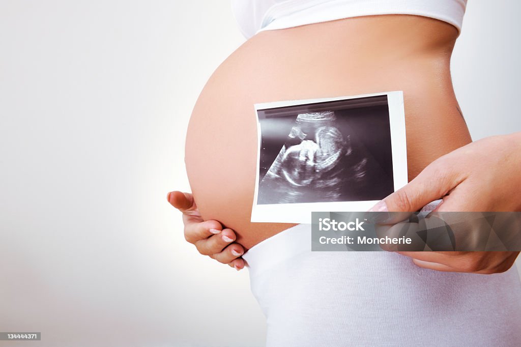 Femme enceinte tenant Échographie image - Photo de Échographie libre de droits